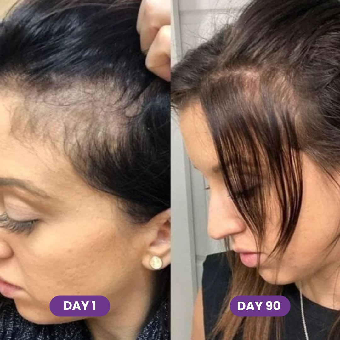 Hair Growth Accelerator Soft Chews